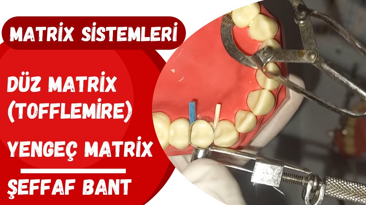 Matrix Sistemleri  ( Yengeç-Düz-Şeffaf Bantlar)