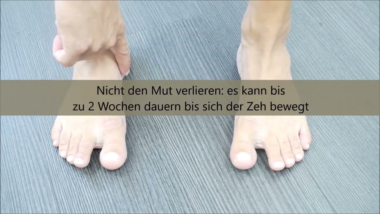 Hallux Valgus exercise: So st&auml;rkst du deine Fu&szlig;muskulatur gezielt! Teil I