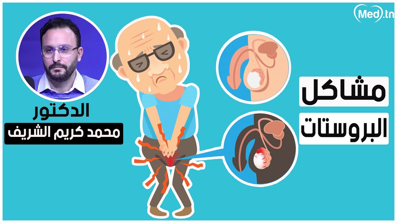 مشاكل البروستات | الدكتور محمد كريم الشريف