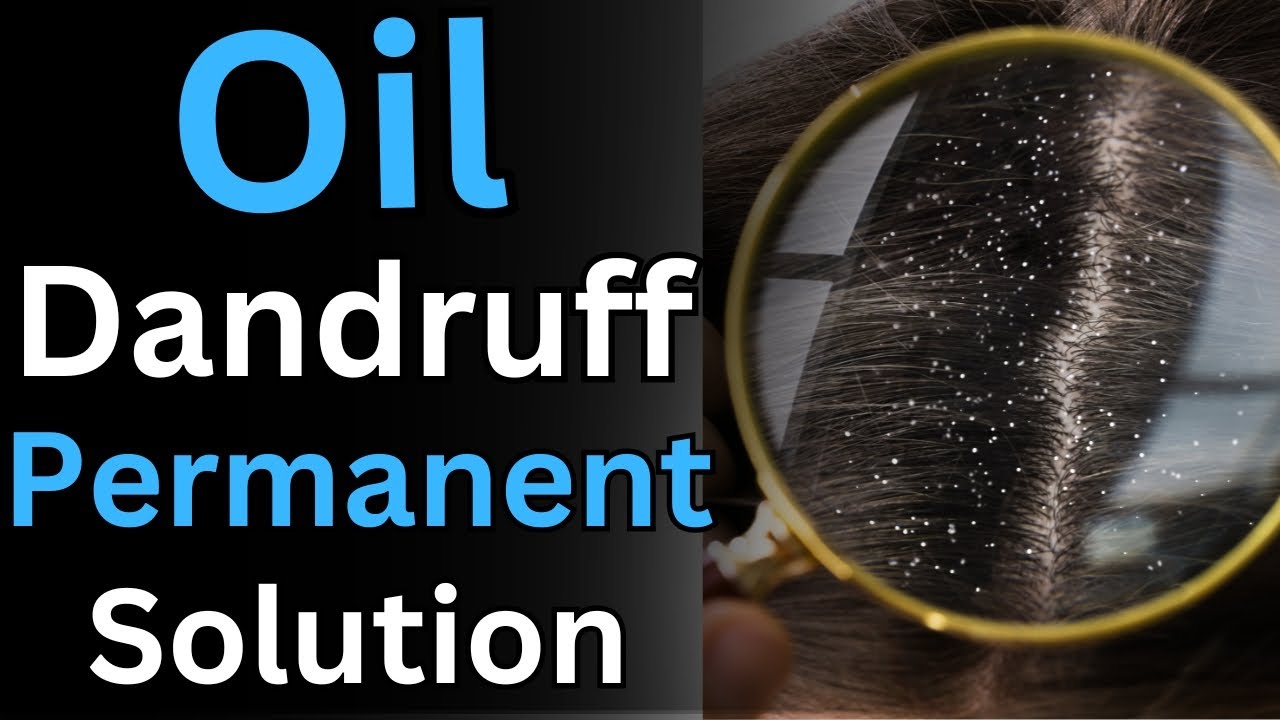 Oily Dandruff: Causes & Treatments | Dr. Mukesh Aggarwal