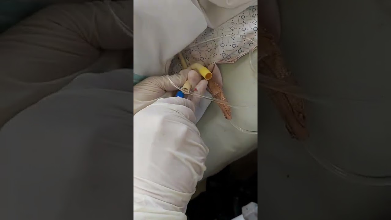 لاول مرة قسطرة بوليه تلاث فتحات