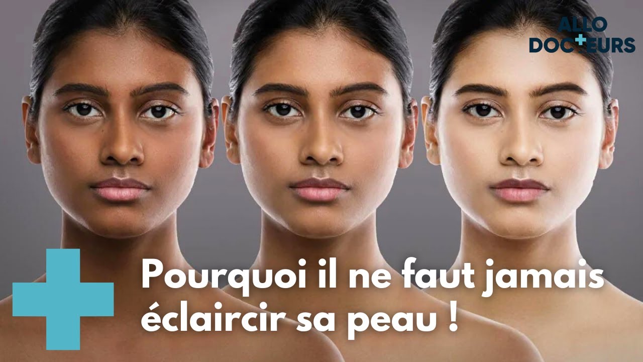 &Eacute;claircir sa peau, une pratique dangereuse - AlloDocteurs