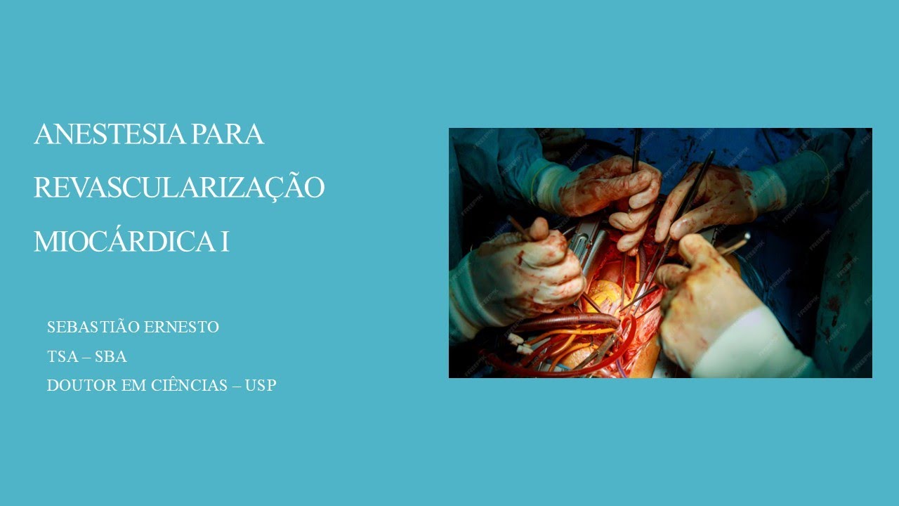 ANESTESIA PARA REVASCULARIZAÇÃO MIOCÁRDICA I
