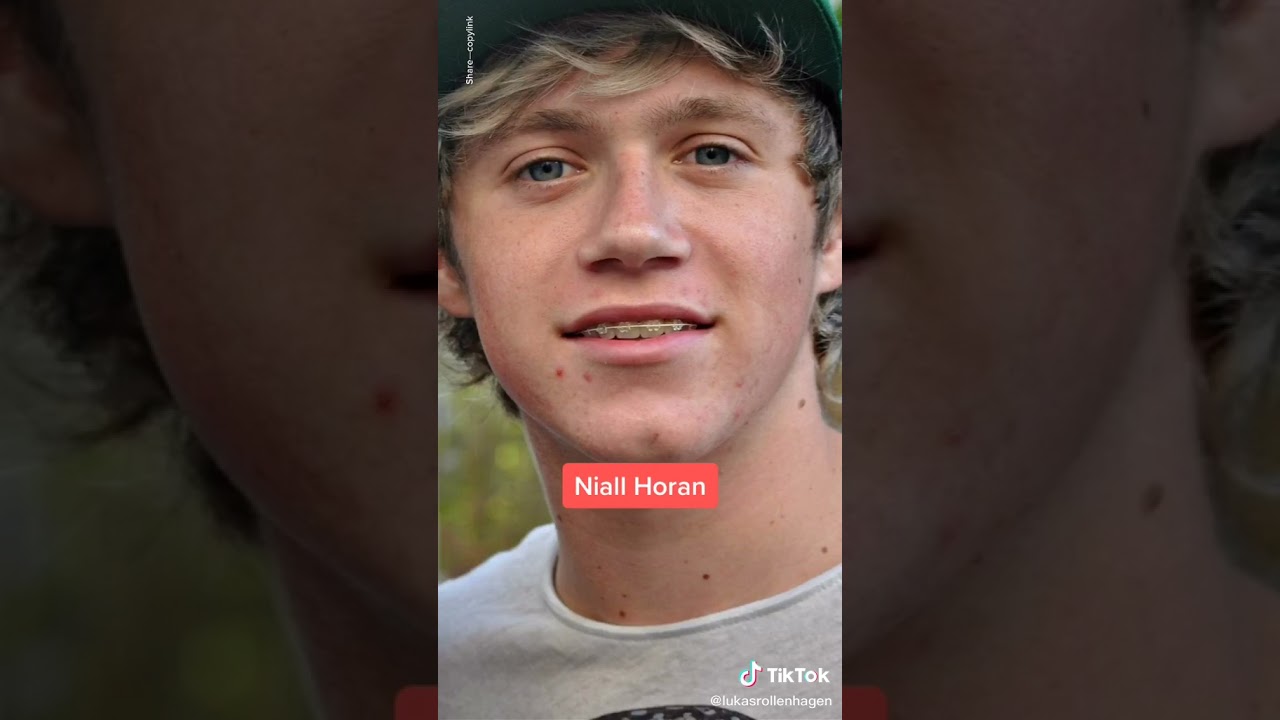Celebrities With Braces (Pt 2) TikTok: lukasrollenhagen