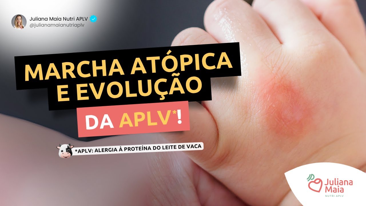 Marcha atópica e evolução da APLV!