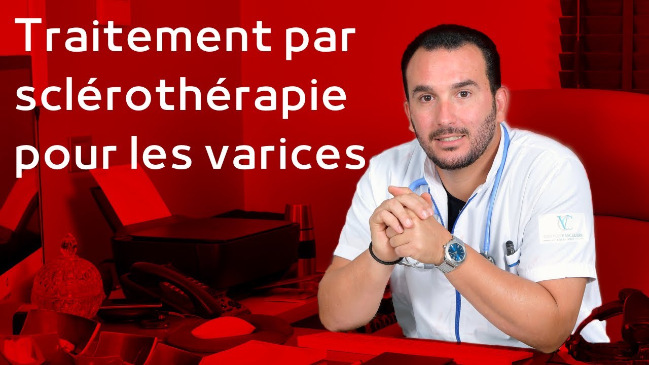 Traitement par scl&eacute;roth&eacute;rapie pour les varices