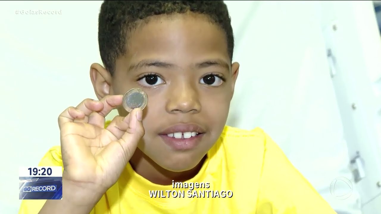 Menino engole moeda e vai parar no hospital