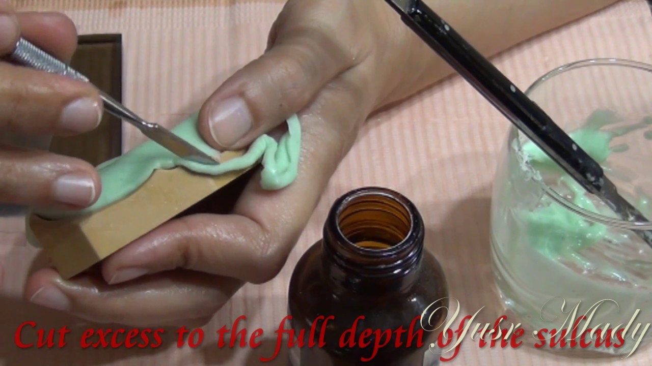 2 - Construction Of Occlusion Rims