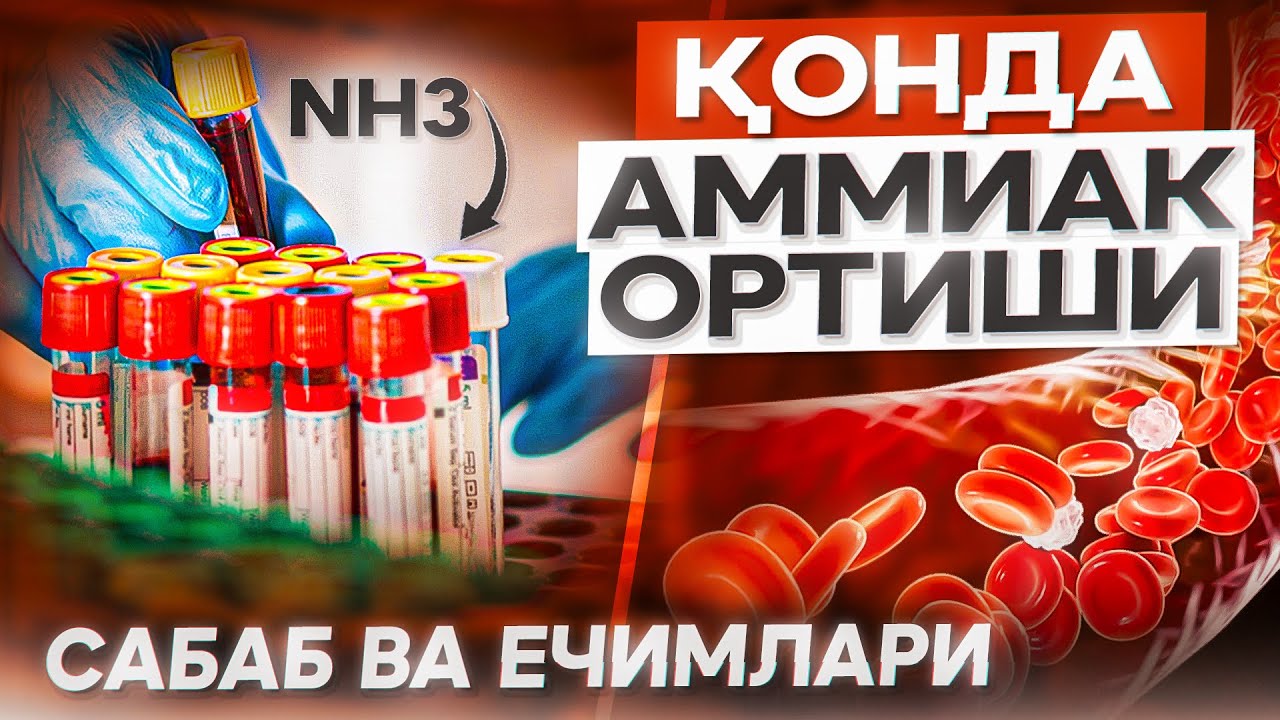 Қонда аммиак ортиши сабаб ва ечимлари | Гипераммониемия | Доктор Гулбаҳор