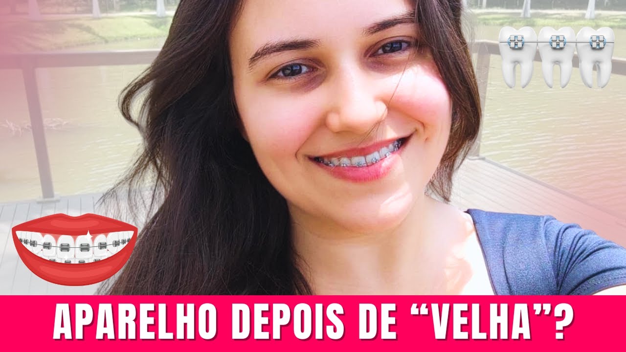 “Velha” pra aparelho? Por que decidi colocar aos 26 anos