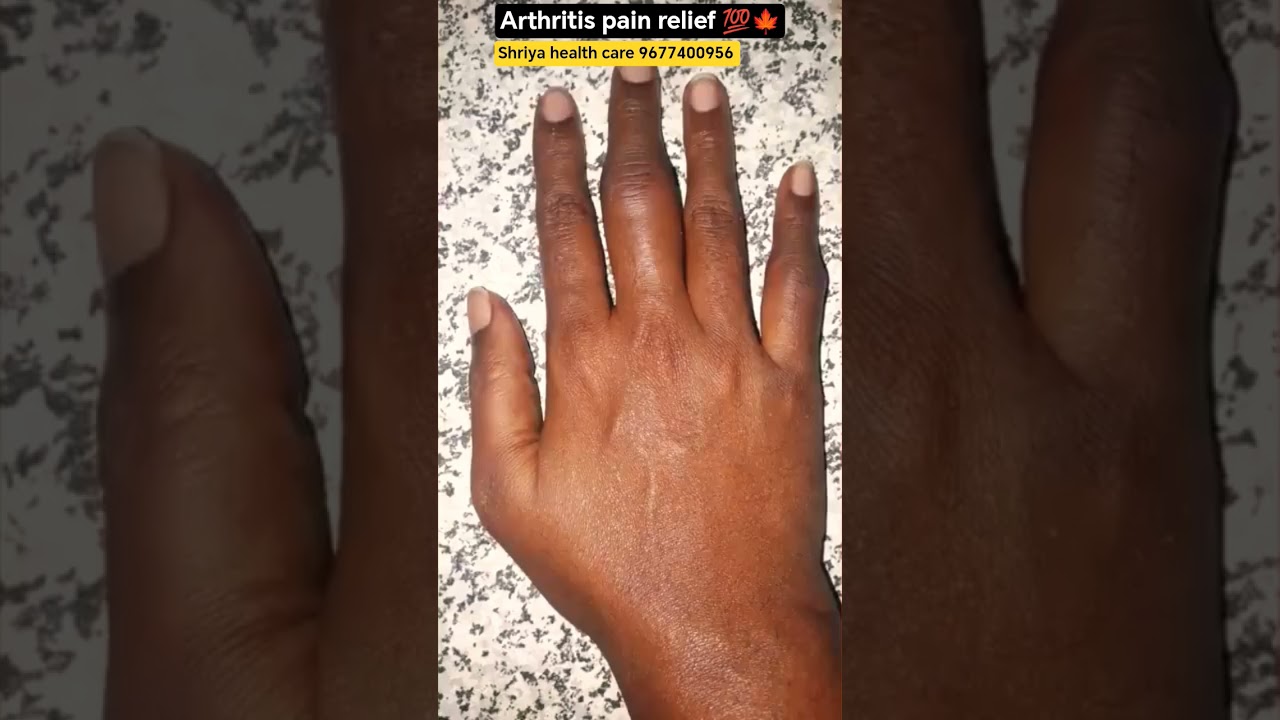 Arthritis pain  💯🍁