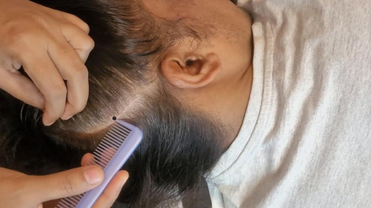 Ultimate Sleep Triggers, Scalp Checking ASMR To Fall Asleep Fast ✨🌿