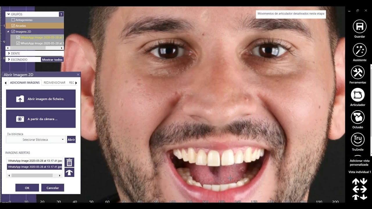 Colocando Foto em Projeto Sem módulo Smile
