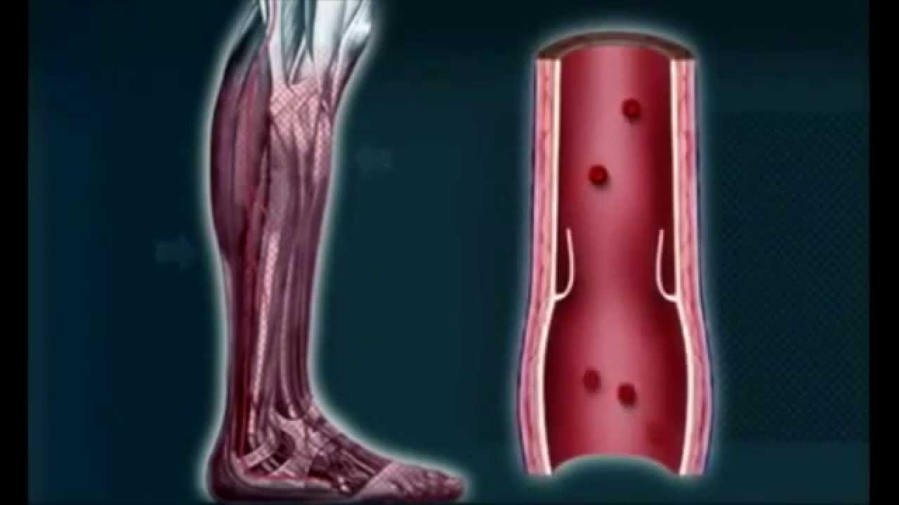 How Compression Socks Work