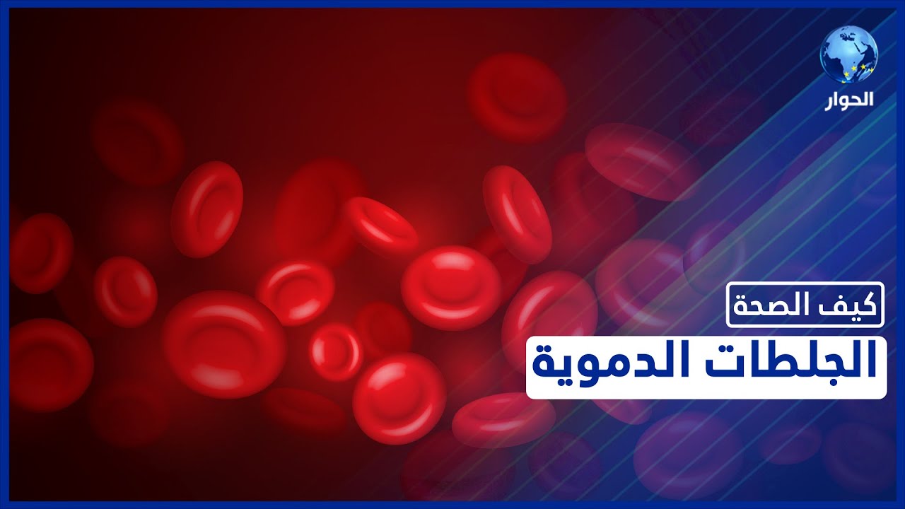 تعرفوا على أنواع الجلطات الدموية ومخاطرها وكيفية تفاديها | كيف الصحة