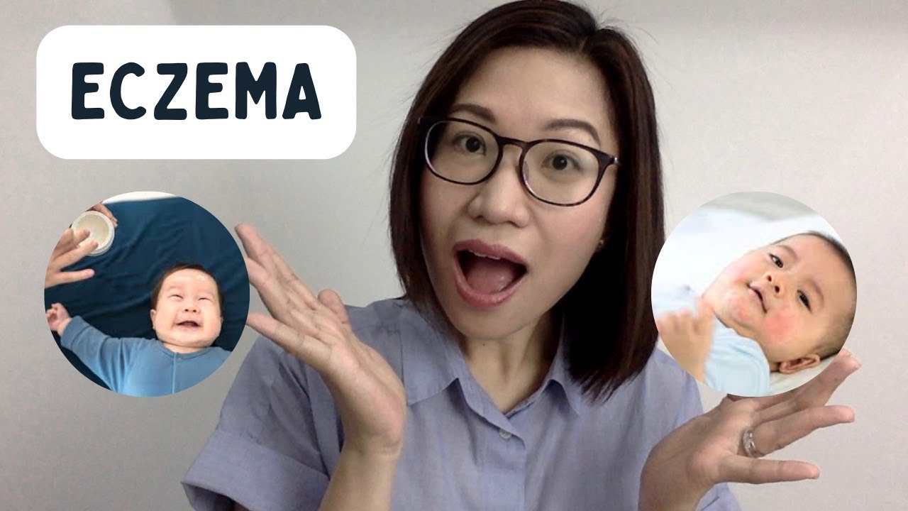 Eczema (Atopic Dermatitis): How to take are of baby's sensitive skin | Dr. Kristine Alba Kiat