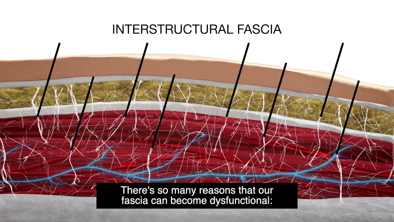 Benefits of FasciaBlasting, by Ashley Black
