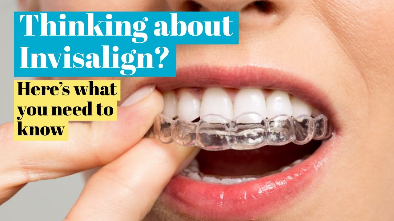 Thinking about Invisalign, here's what you need to know