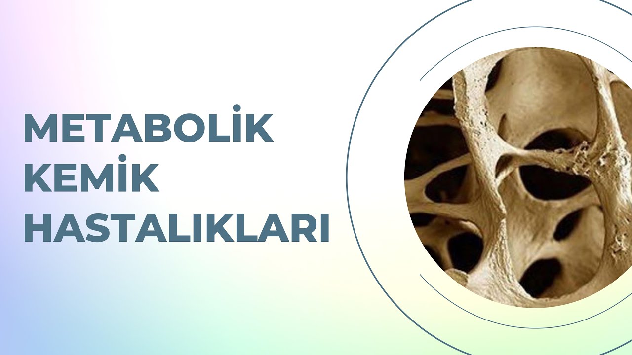 Metabolik Kemik Hastalıkları (Örnek Video 4)
