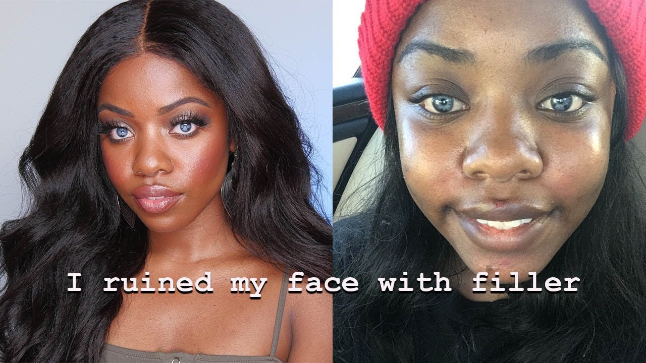 I Ruined My Face, Pretty Privilege, Insecurities | Makeup & Mindset