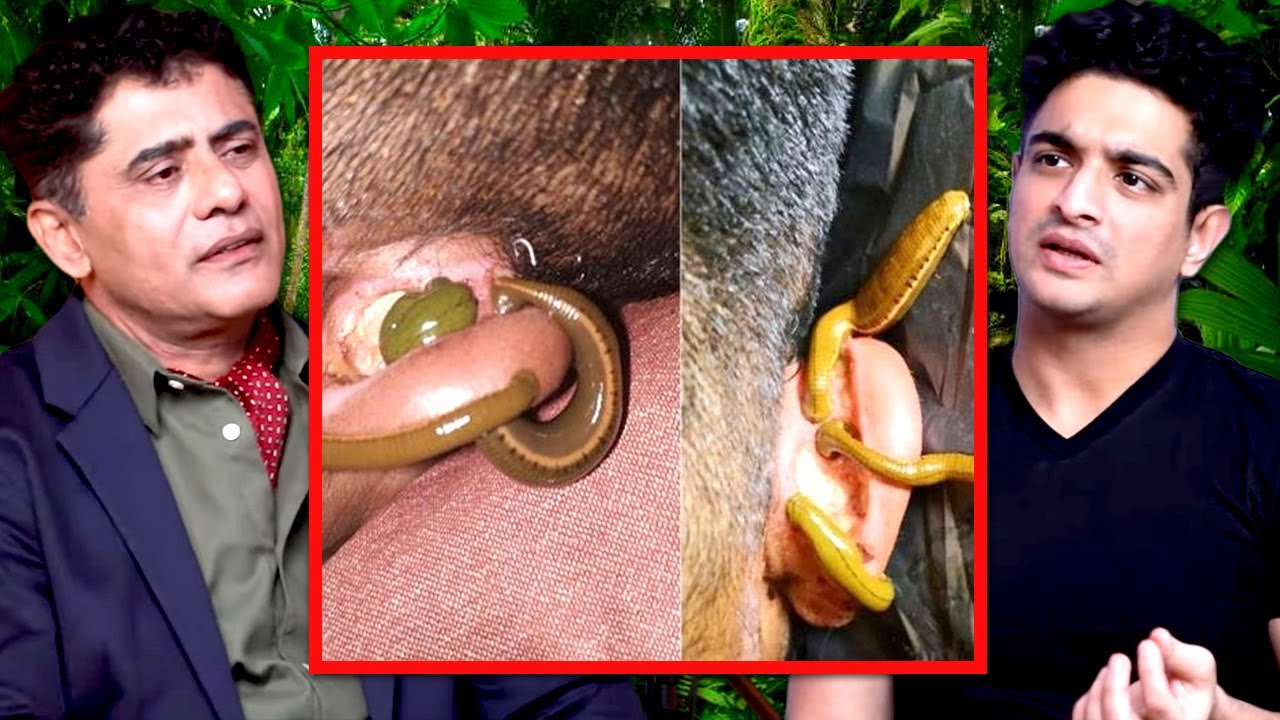 जंगली Leeches का जानलेवा हमला - उपाय क्या है?