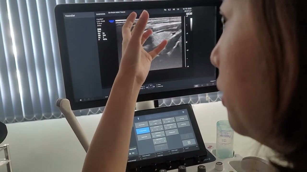 Hướng dẫn si&ecirc;u &acirc;m động mạch cảnh, đốt sống