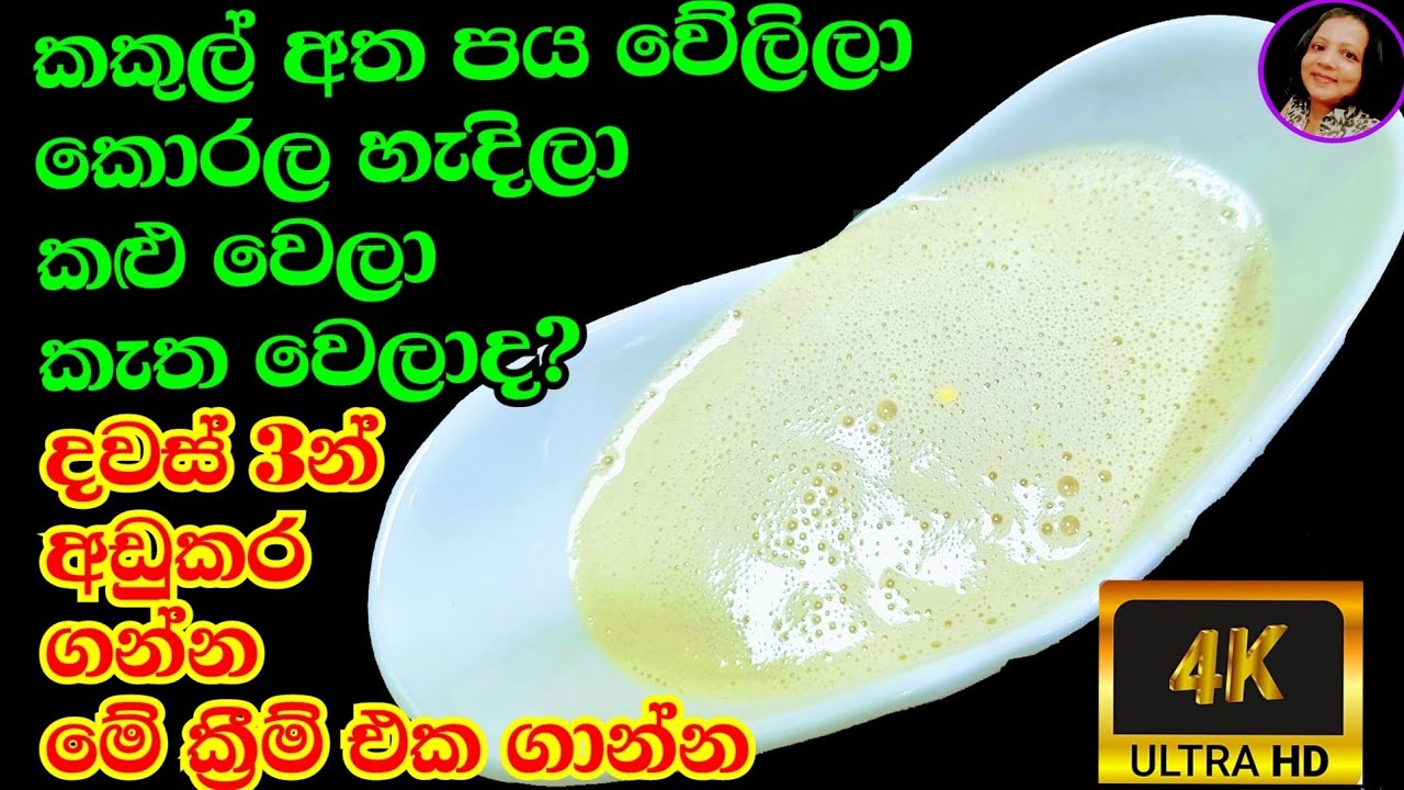 සතියක් යන්න කලින් මුළු සිරුරම ලස්සන කරන ක්‍රීම් එකක් Dry Skin Treatment My Charm Life 4K Video