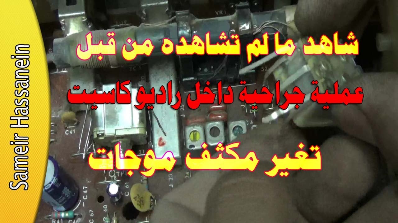 اكبر عملية جراحية داخل راديو كاسيت  تغير مكثف 4 موجة