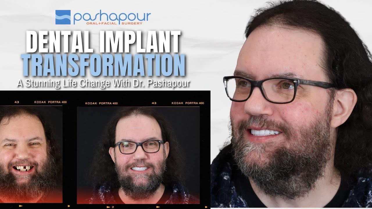 From Constant Fear to Total Relief: A Life Changed by Dental Implants