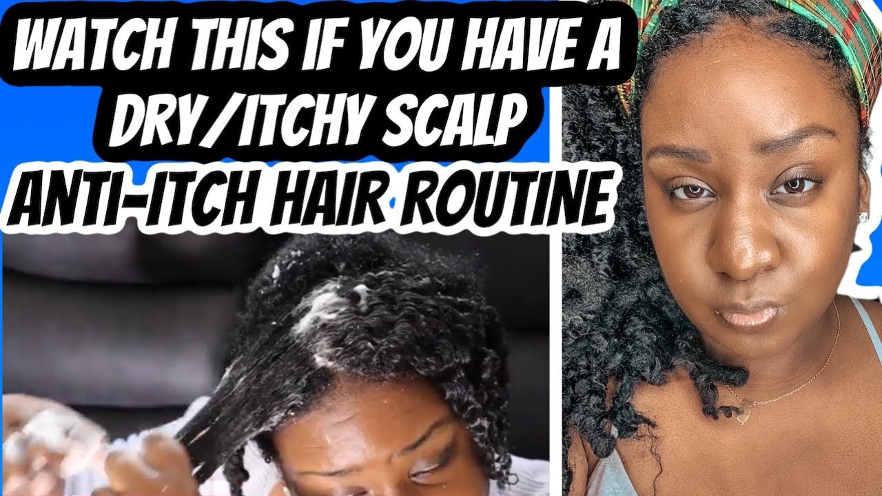 Dry Natural Hair|Itchy Scalp|Treating Dandruff| Healthy Scalp Care Tips| Natural Hair