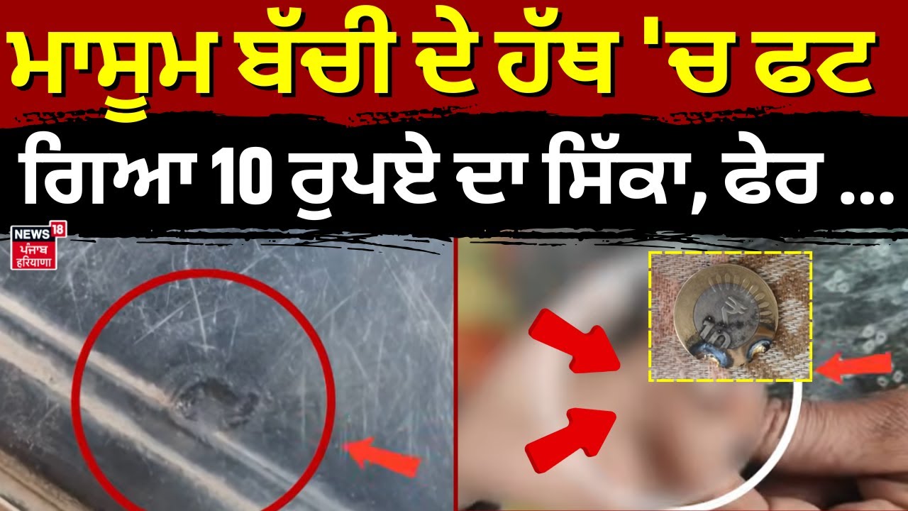 Abohar News | ਮਾਸੂਮ ਬੱਚੀ ਦੇ ਹੱਥ 'ਚ ਸਿੱਕਾ ਫਟ ਗਿਆ 10 ਰੁਪਏ ਦਾ ਸਿੱਕਾ, ਫੇਰ ...| Coin Blast | N18V