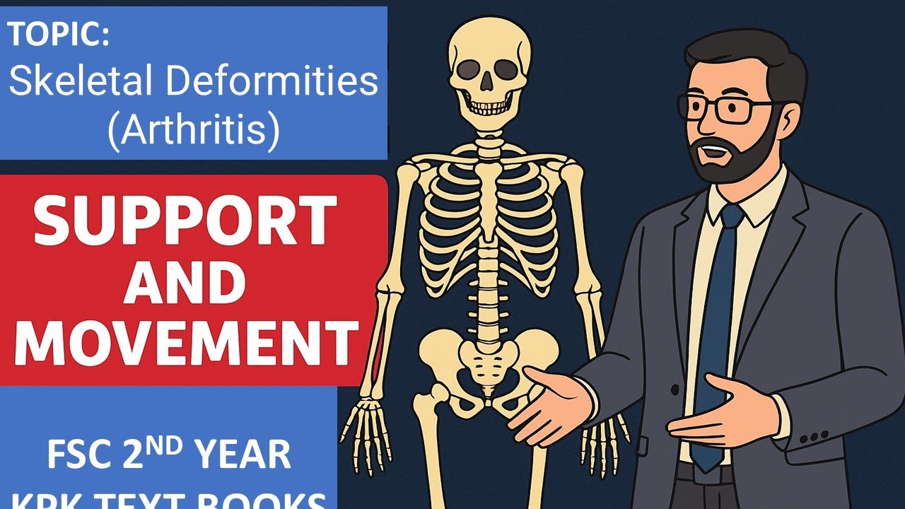 Skeletal Deformities (Arthritis) | Biology 2nd Year | FSc #2ndyearbiology #fscpart2 #arthritis 