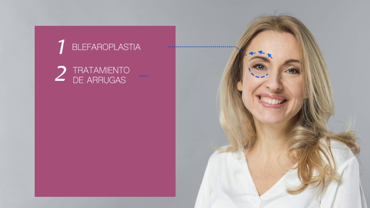 PLEXR PLASMA TECNOLOG&Iacute;A SIN CIRUGIA