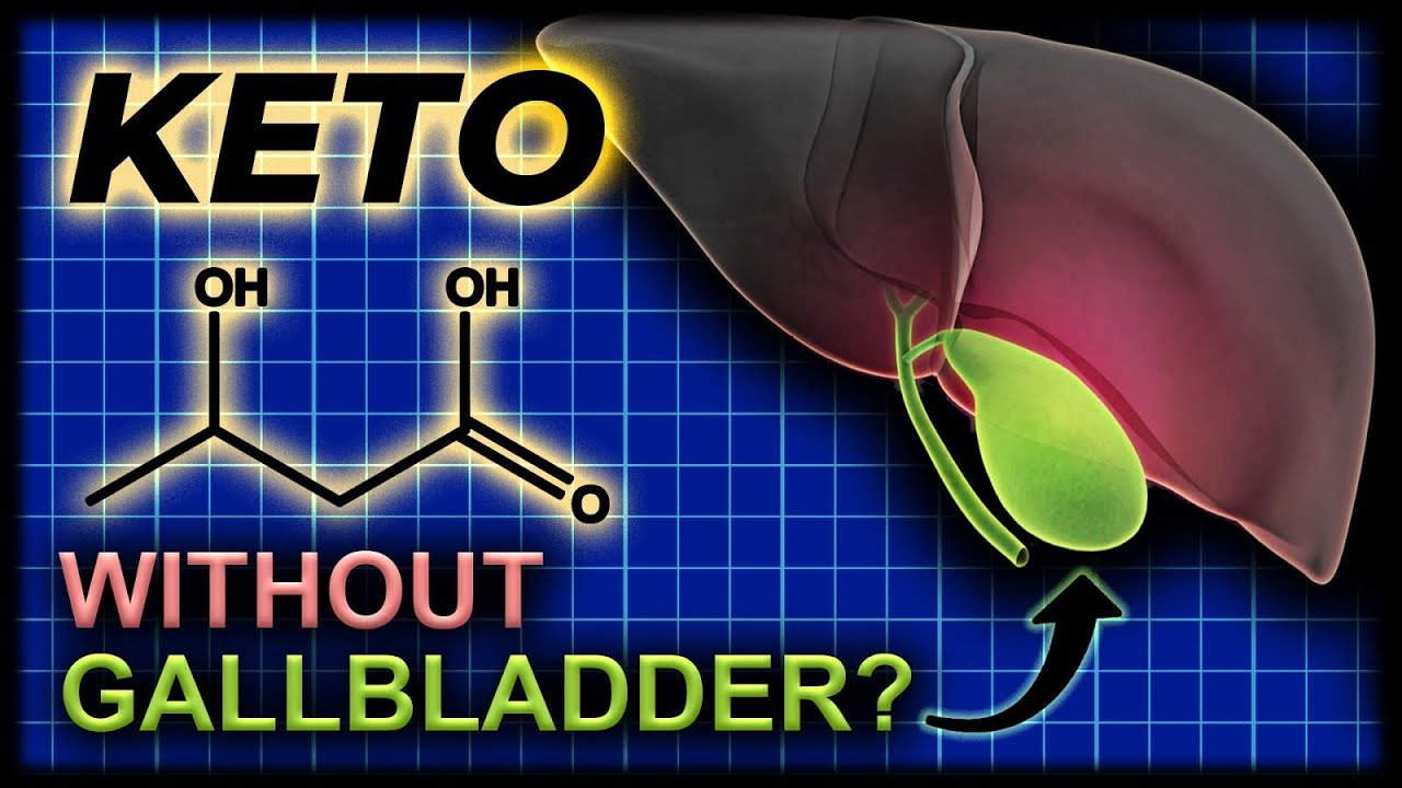 Can you do KETO WITHOUT A GALLBLADDER!?
