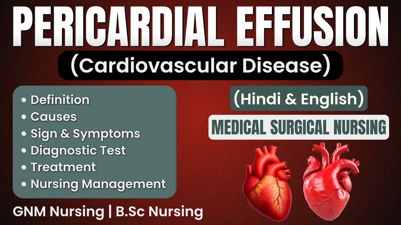 Pericardial Effusion // Pericardial Effusion In Hindi // Pericardial Effusion Treatment In Hindi