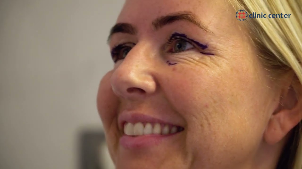 Eyelid Surgery | Suzanne's Medical Journey | Clinic Center Turkey
