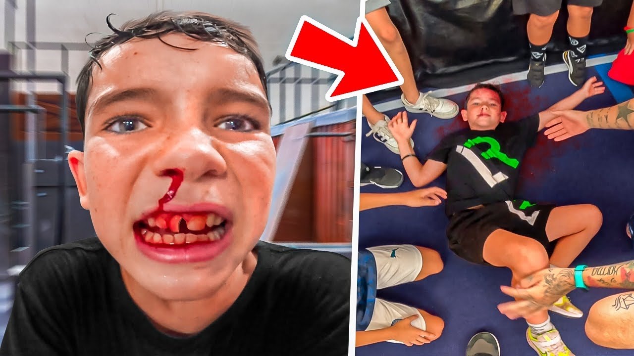 NIÑO de 9 AÑOS tiene un ACCIDENTE haciendo PARKOUR😢💔