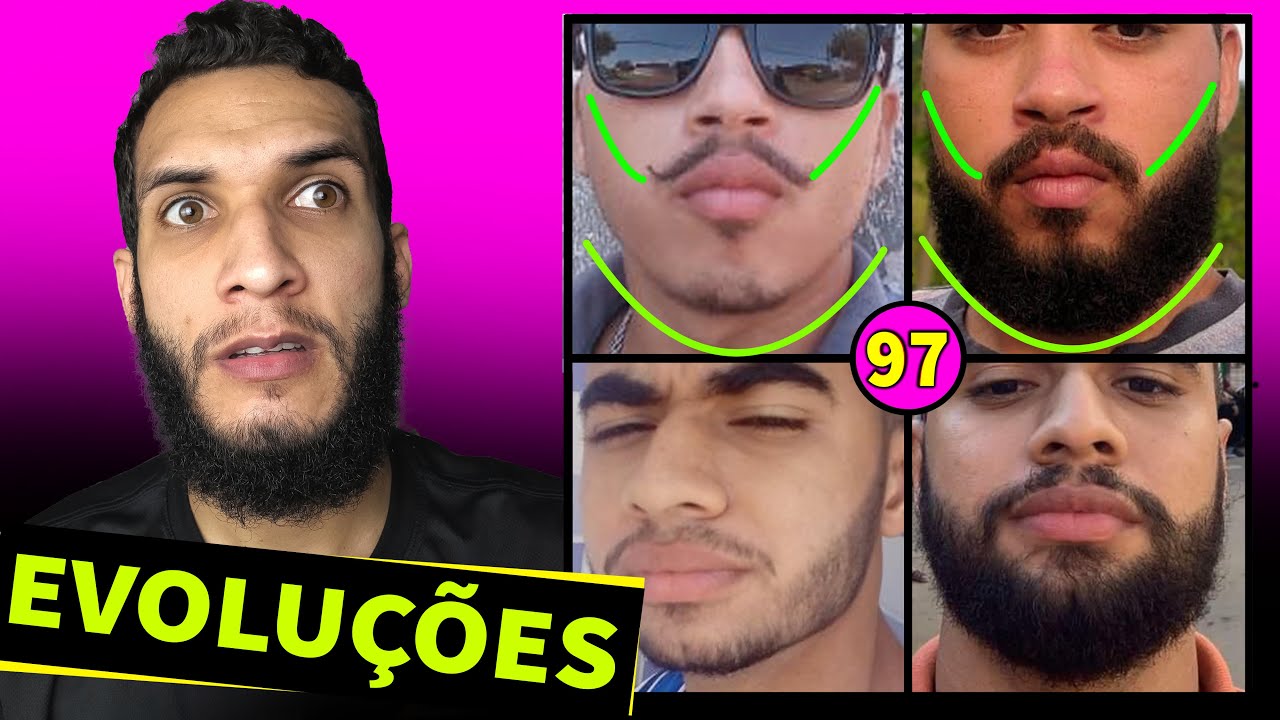 EVOLUÇÃO DOS INSCRITOS / MINOXIDIL #97 (antes e depois)