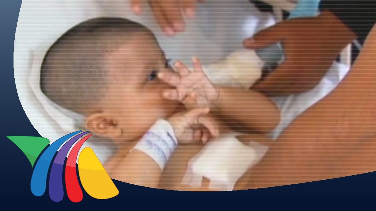 Piden ayuda para bebé con hidrocefalia | Noticias