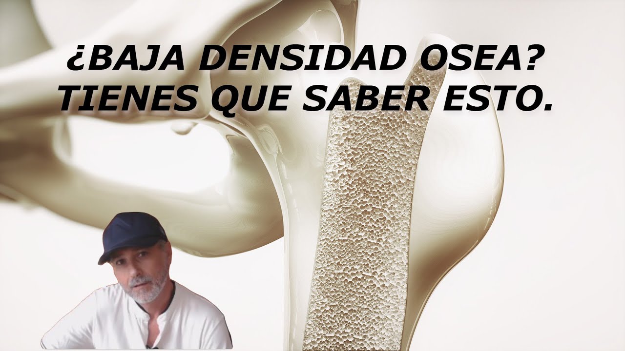&iquest;Baja densidad &oacute;sea? &iquest;Qu&eacute; est&aacute; fallando? La ESCLEROSTINA.