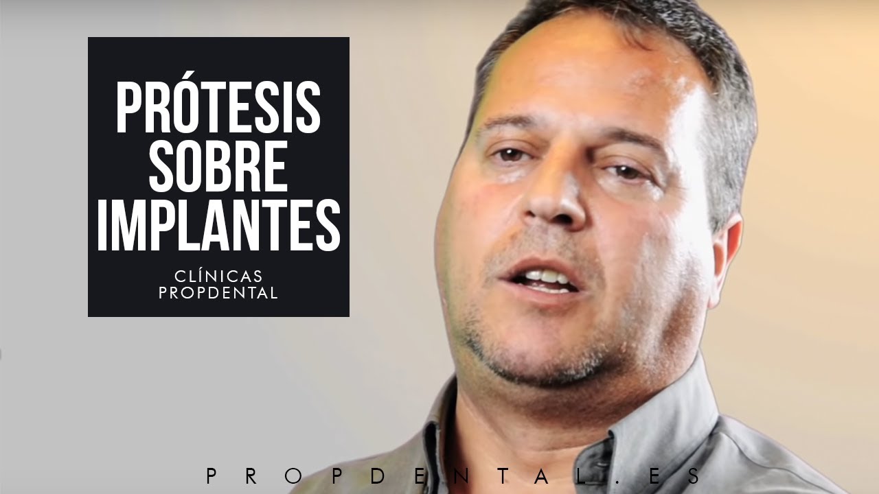 Implantes dentales el testimonio del Sr. Carlos