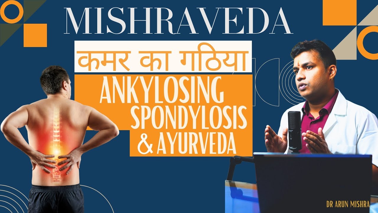 Live-58:Ankylosing spondylosis-कमर का गठिया रोग & आयुर्वेद  #mishraveda #oj Ayurveda #drarunmishra