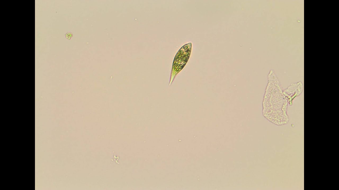 Under the microscope: Euglena