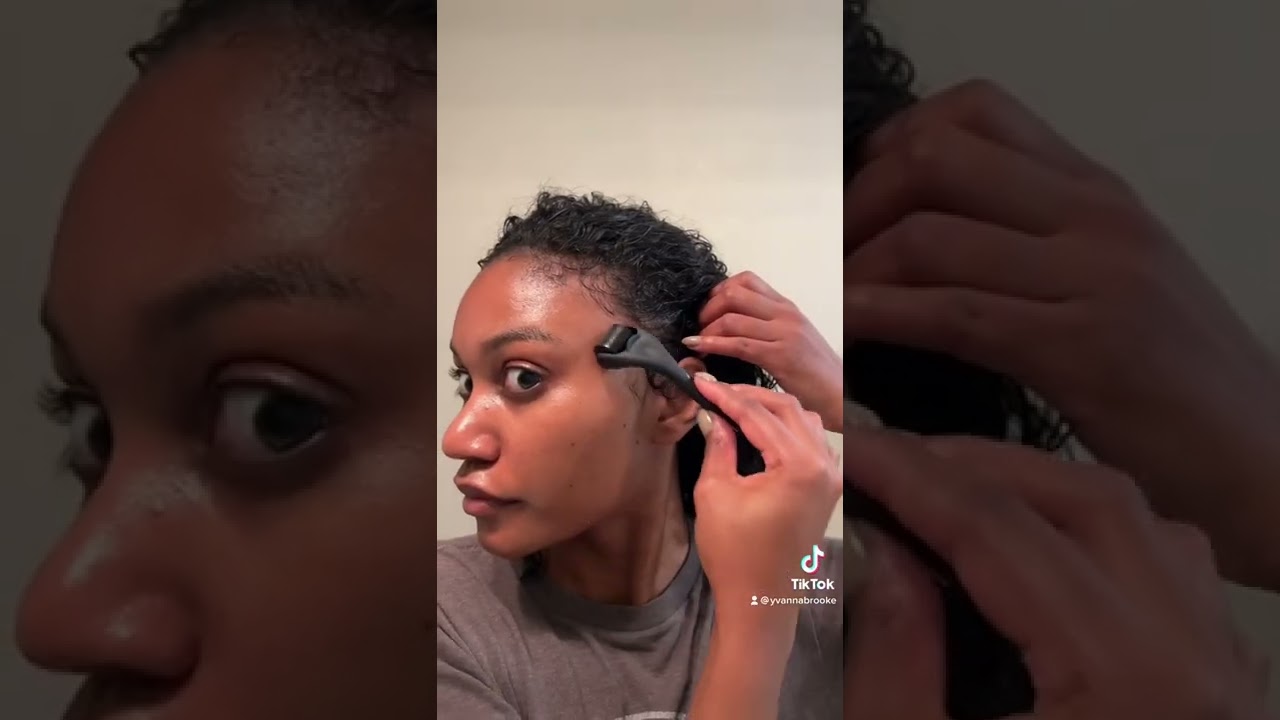 // Get your edges back with dermarolling