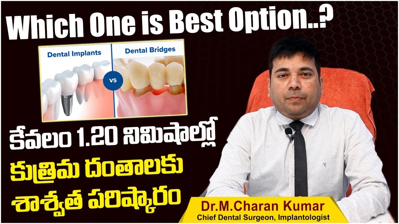 కుత్రిమ దంతాలకు బెస్ట్ ఇదే | Dental Implant vs Bridge | Teeth Replacement | Eledent Dental Hospital