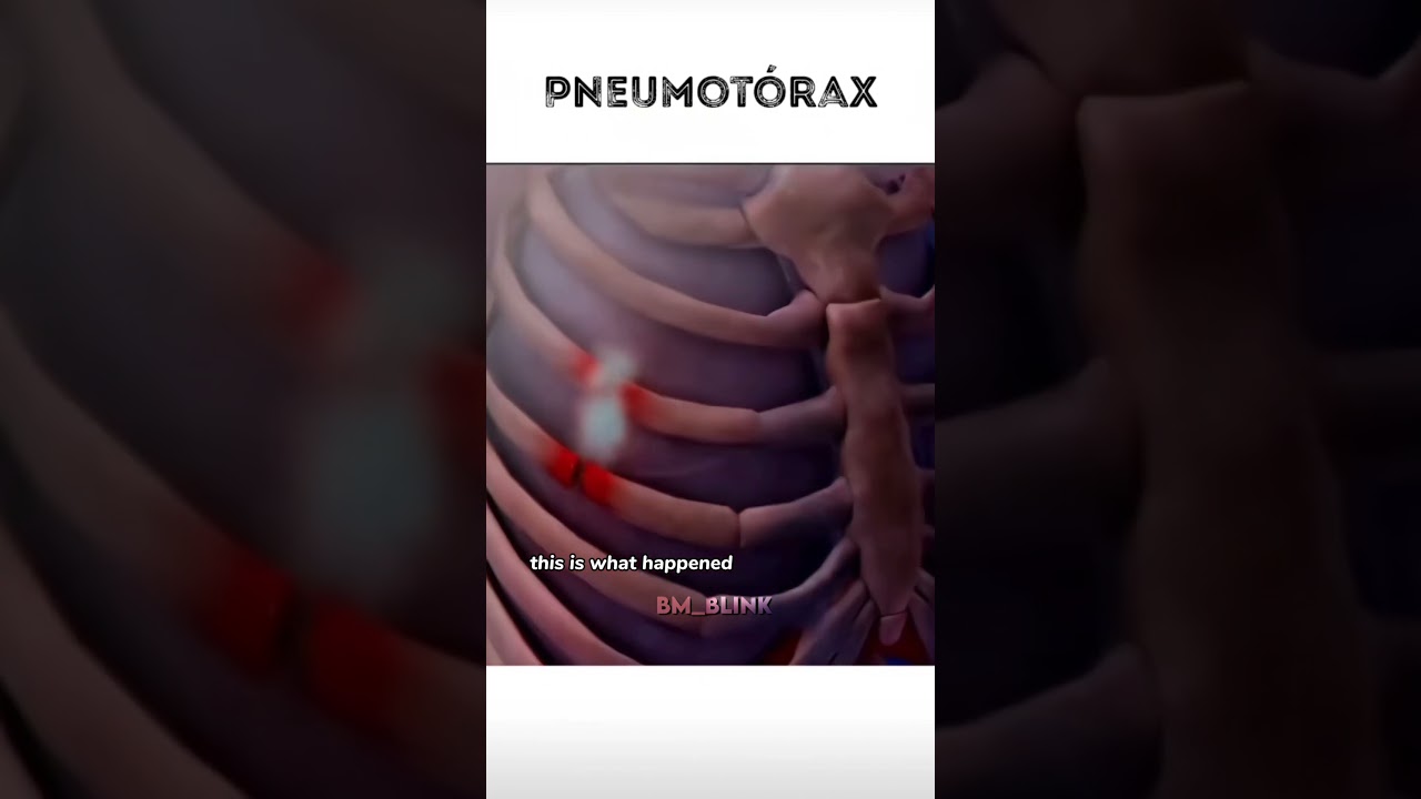 новости о Рами 😭?#shorts #rami #babymonster #viralvideo #fypviralシ