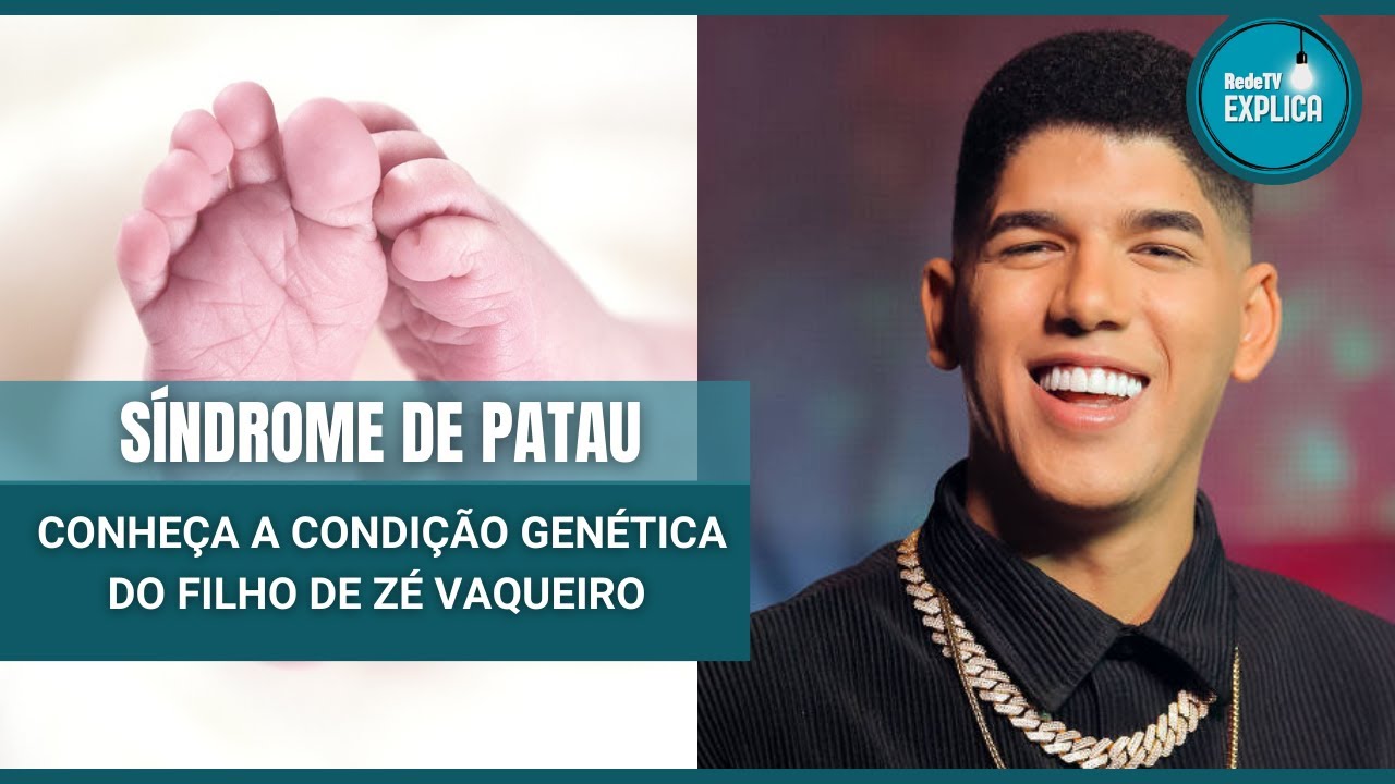 Síndrome de Patau: Conheça a condição genética do filho do cantor Zé Vaqueiro - RedeTV Explica