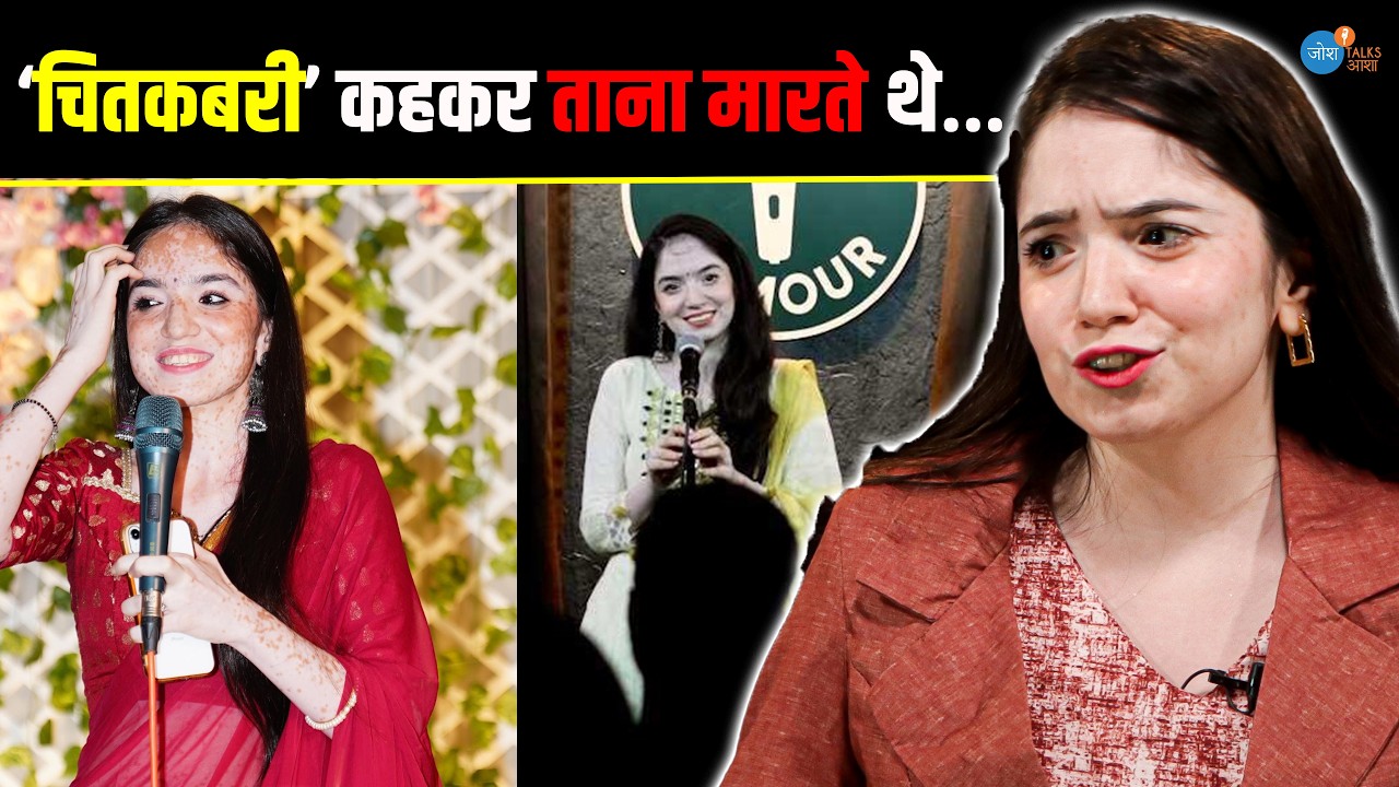 लोग बोले, मछली और दूध साथ में खा लिया होगा | @anmolllaroraaaa  | Vitiligo Awareness | Josh Talks