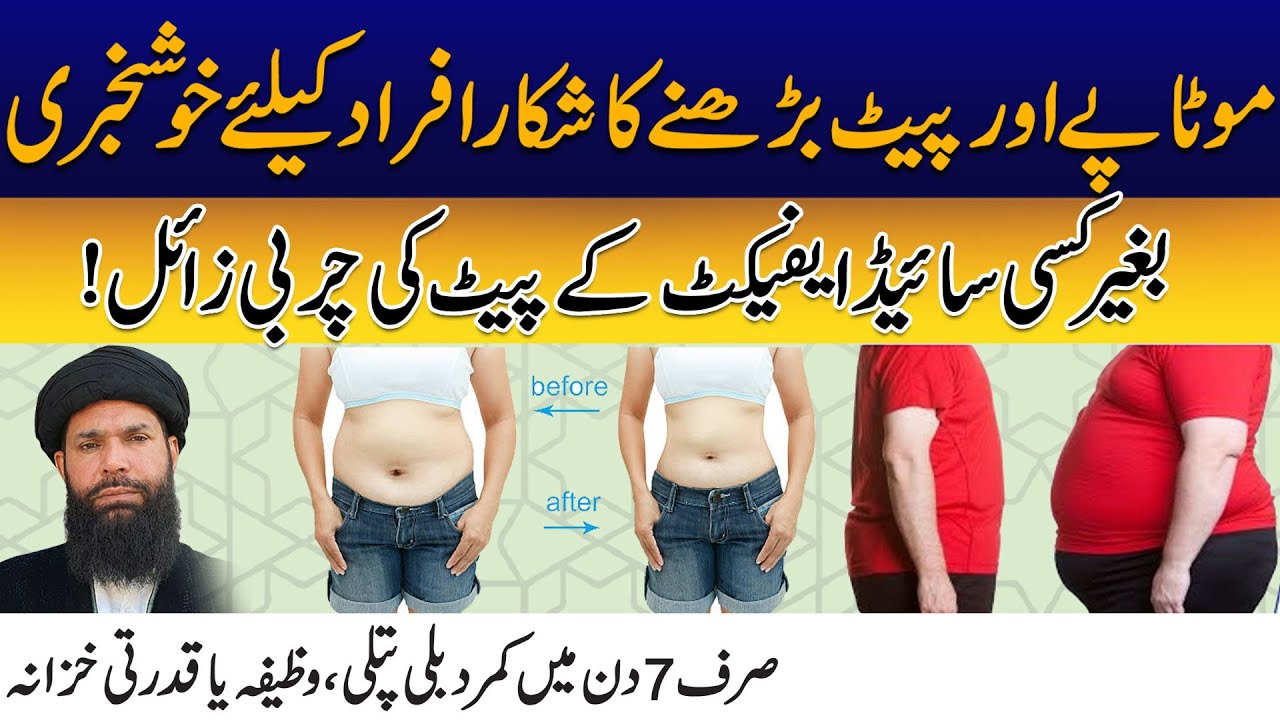 Motapy Say Chutkara | Hakeem Tariq Mehmood | Ubqari | City42
