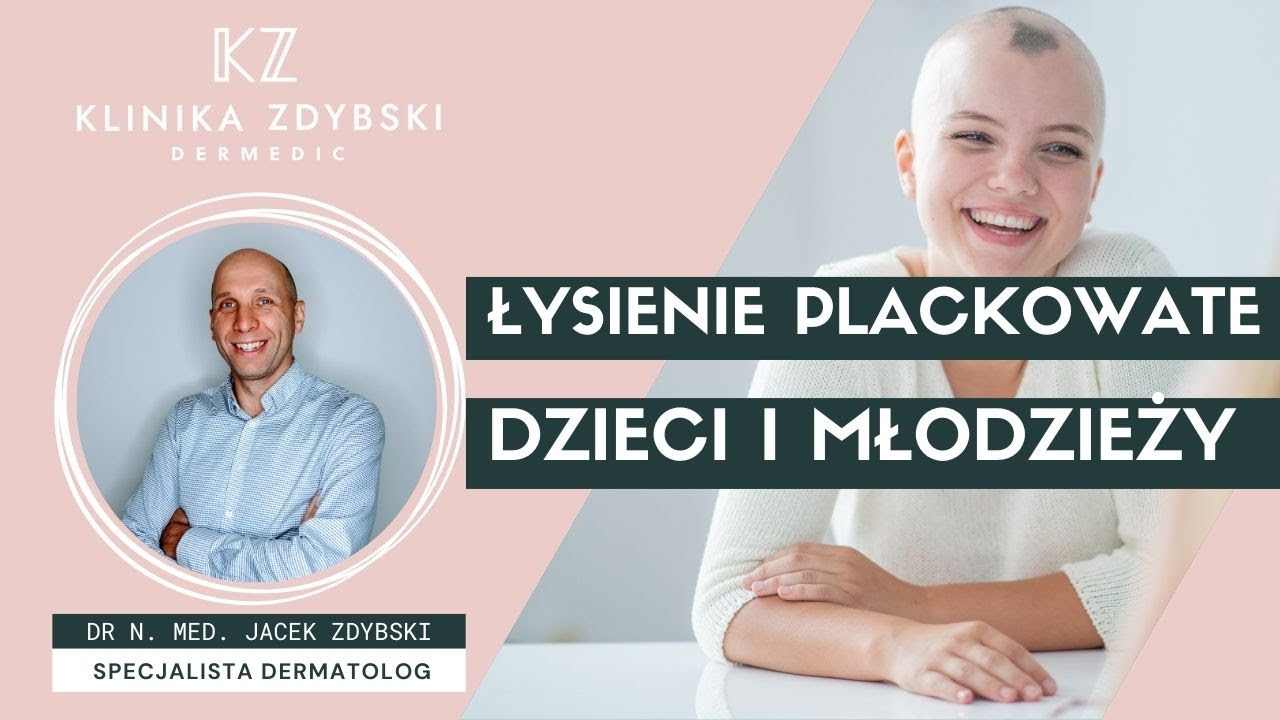 Dermatolog mówi o: Łysienie plackowate u dzieci i młodzieży
